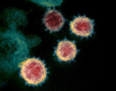 Pozitivně naladěný a aktivní člověk je pro virus nevhodným cílem – rozhovor s biochemikem Markem Cebecauerem o SARS-CoV-2, testování virů a jejich chování pro kurzy.cz Pozitivně naladěný a aktivní člověk je pro virus nevhodným cílem – rozhovor s biochemikem Markem Cebecauerem o SARS-CoV-2, testování virů a jejich chování pro kurzy.cz